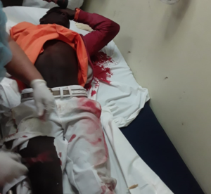 En Polo; Hombre sufre traumas severo al desliarse motocicleta