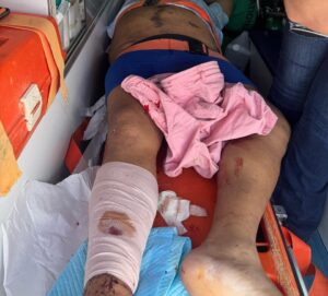 f022fd71-e0f9-42a3-b65b-b9796fbbe432