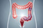 Salud Pública llama a mayores de 45 años a someterse a chequeos para prevenir el cáncer de colon